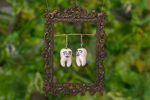 Chipped Tooth