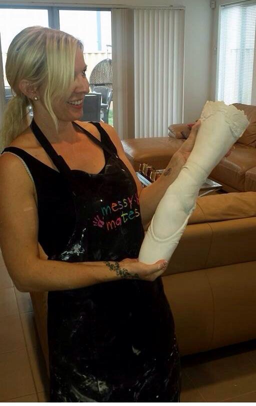 Ballerina Partial Leg Cast