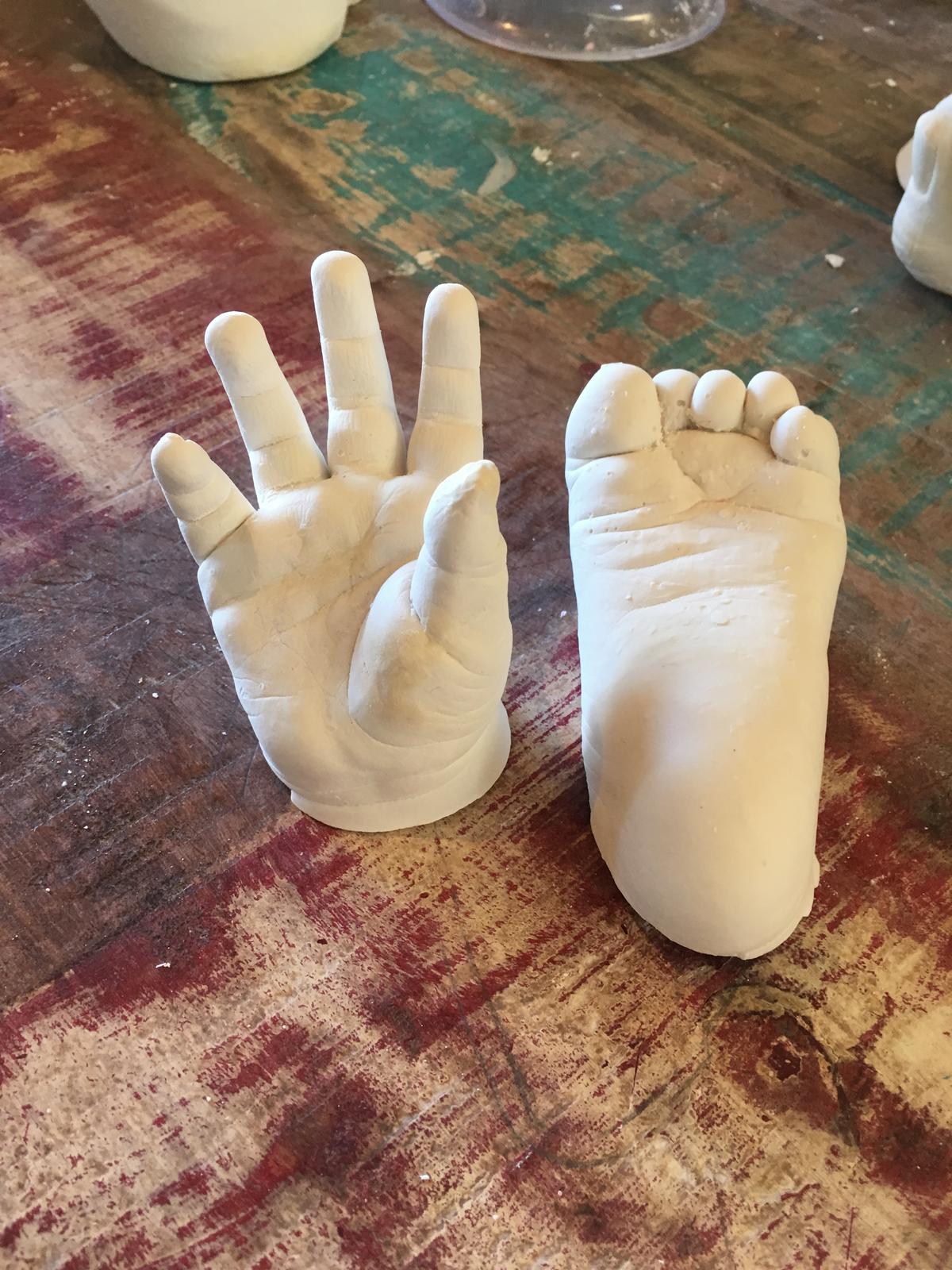 Baby Hand and Foot Cast